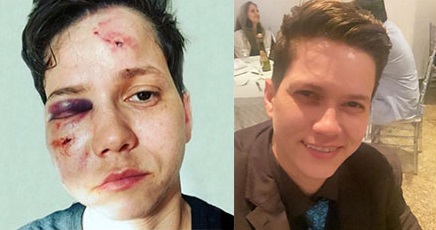 Karol ficou com o rosto desfigurado após agressões (Foto: Reprodução Twitter @BolsonaroSP e Instagram @karolelleroficial)