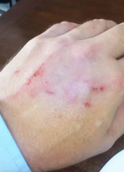 Imagem ilustrativa da imagem Gerente de padaria é agredido por homem em situação de rua em Jardim Camburi