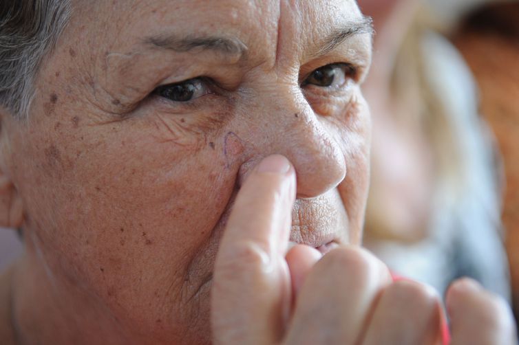 Tratamento de câncer de pele (Foto: Fabio Rodrigues Pozzebom/ Agência Brasil)