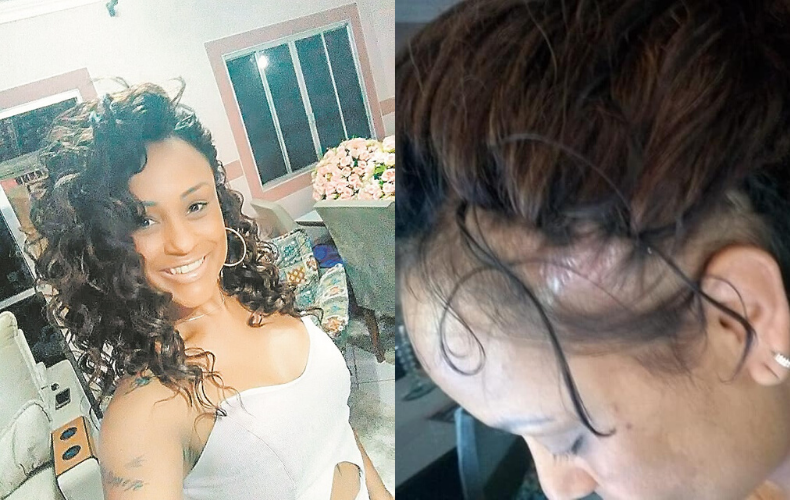 Na primeira foto, Edna havia acabado de colocar o aplique. A segunda foi tirada dias depois (Foto: Reprodução/Arquivo Pessoal)