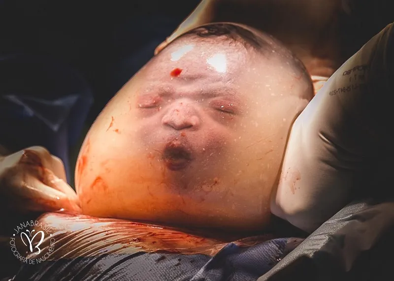 Imagem ilustrativa da imagem FOTOS | Veja o bebê capixaba empelicado em outros ângulos