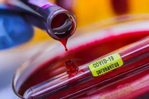 Imagem ilustrativa da imagem Dois parlamentares do Estado fazem teste de coronavírus