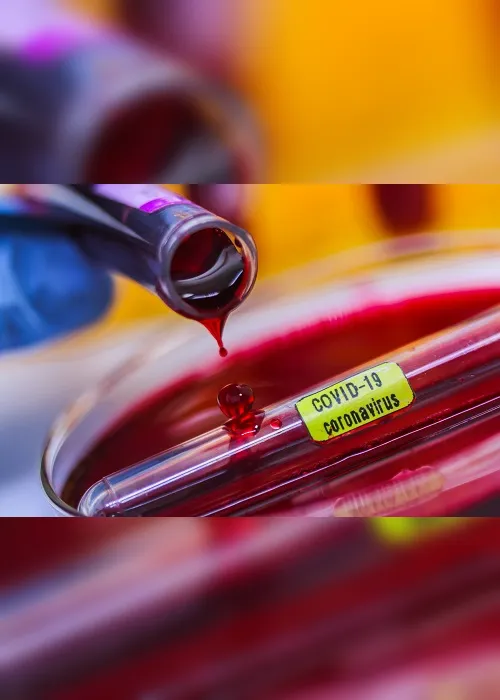Imagem ilustrativa da imagem Em apenas um dia, hospital faz 492 testes para coronavírus