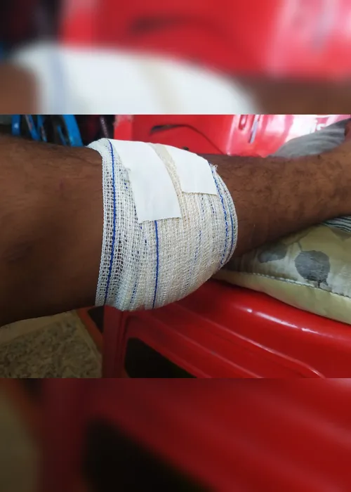 Imagem ilustrativa da imagem Tiroteio deixa um morto e um ferido em Vila Velha