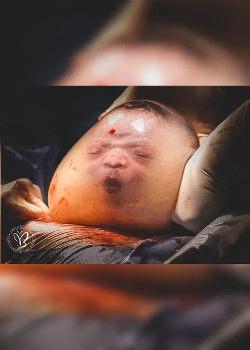 Imagem ilustrativa da imagem FOTOS | Veja o bebê capixaba empelicado em outros ângulos