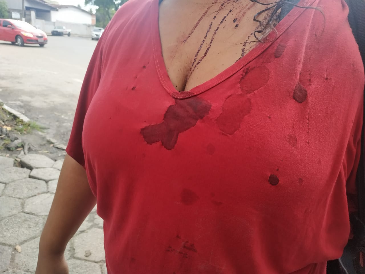 Vítima entrou em luta corporal com suspeito e foi agredida com coronhadas (Foto: Kananda Natielly)