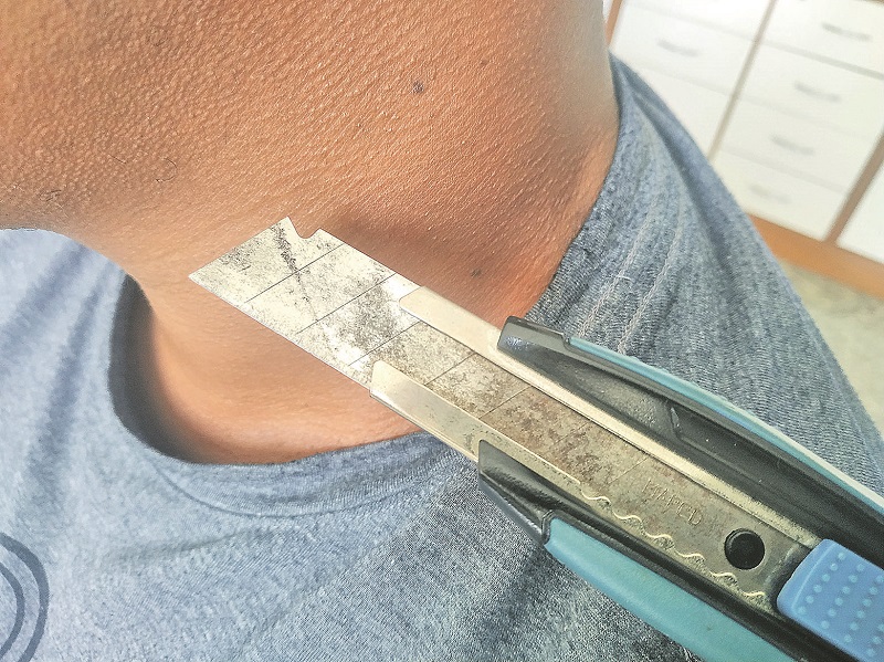 "Colocaram estilete no meu pescoço", disse funcionário do sistema socioeducativo. (Foto: Kananda Natielly)