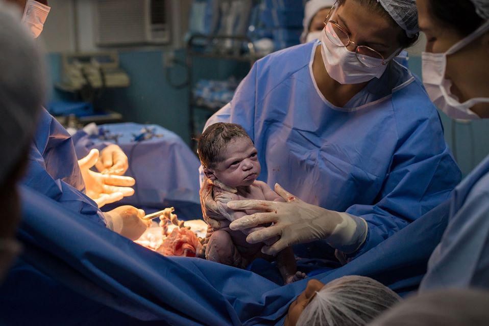 Isabela, a bebê "zangada" que virou meme ao nascer (Foto: Rodrigo Kunstmann)