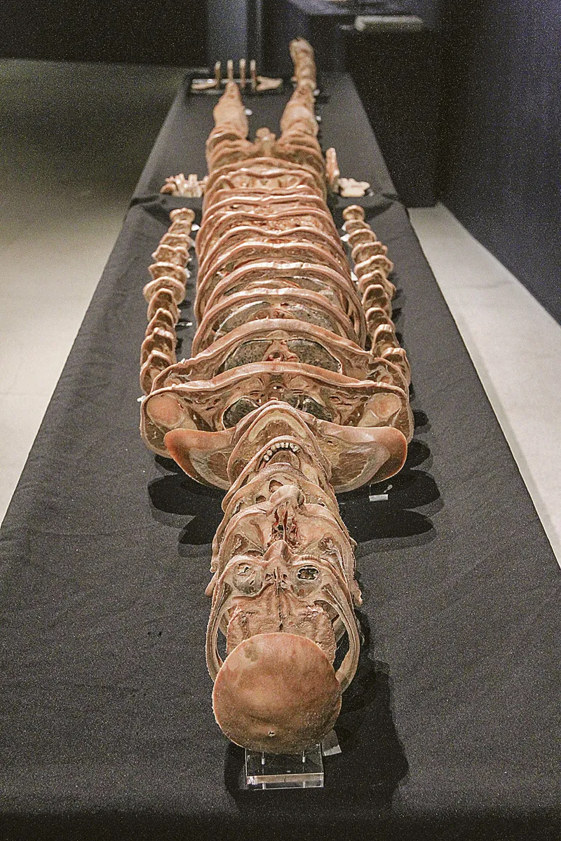Imagem ilustrativa da imagem Novidades em museu do corpo humano na Ufes