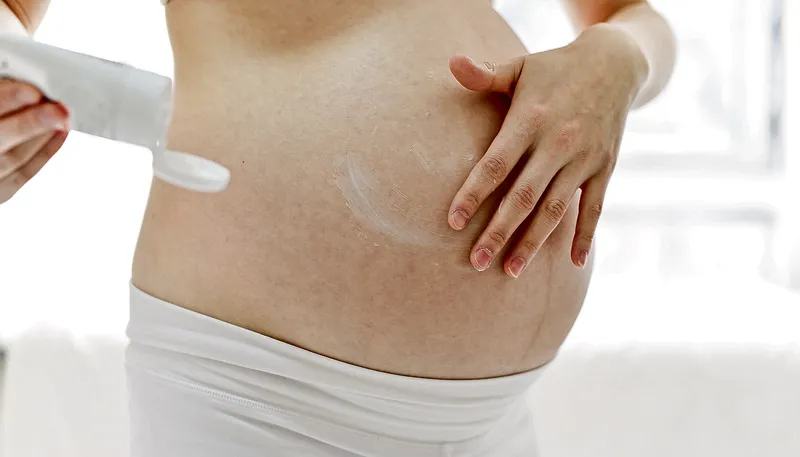 Imagem ilustrativa da imagem Produtos evitam manchas e estrias durante a gravidez