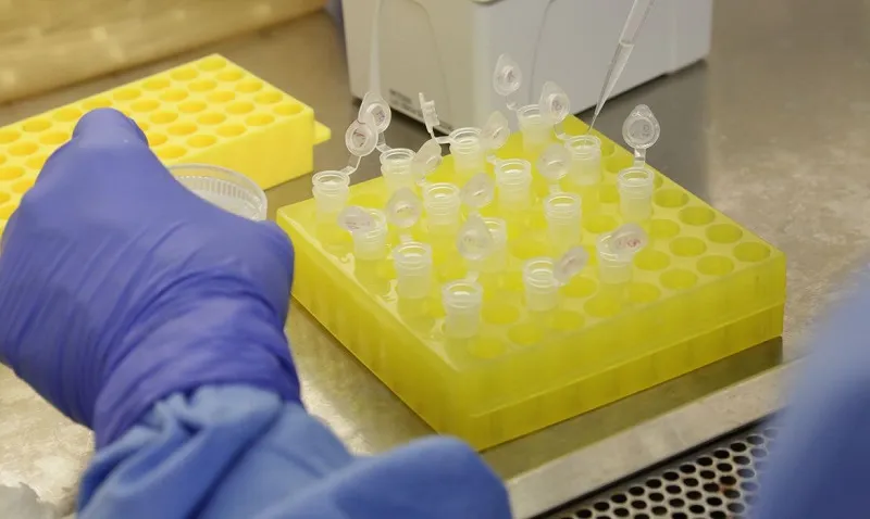 Imagem ilustrativa da imagem Perda de olfato pode indicar infecção pelo novo coronavírus