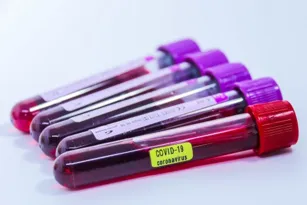 Imagem ilustrativa da imagem Câmara cria novo “recesso” e deixa leis por votar