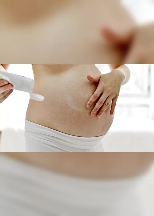Imagem ilustrativa da imagem Produtos evitam manchas e estrias durante a gravidez