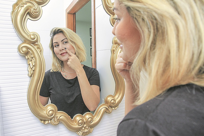 A empresária Bruna Sales, de 25 anos, buscou a cirurgia para tratar disfunções respiratórias e acertar um detalhe estético; (Foto: Dayana Souza/AT)