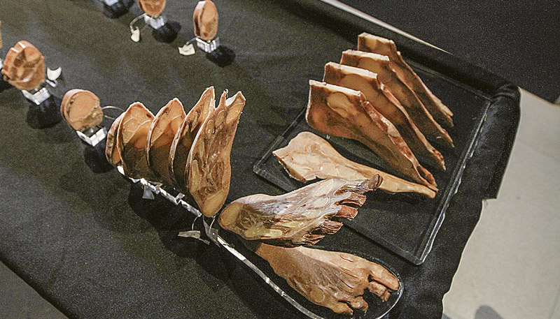 Pé humano em camadas, onde foi aplicado o método da plastinação (Foto: Beto Morais / AT)