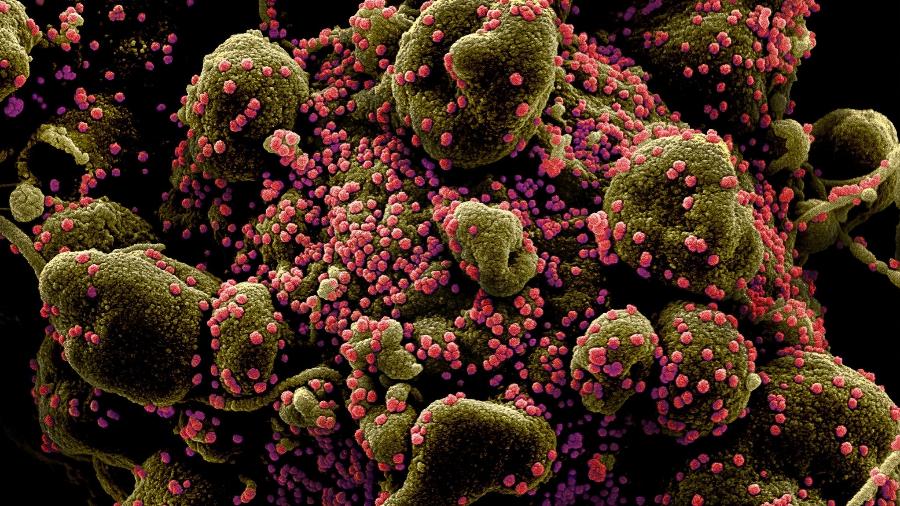 Vírus Sars-COV-2 (em rosa) infectam células humanas, que replicam material genético e morrem (Foto: NIAID)