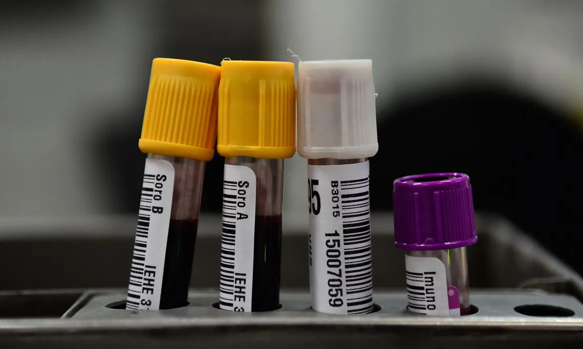 Imagem ilustrativa da imagem Tipo sanguíneo e genes estão ligados à Covid-19 grave, mostra estudo