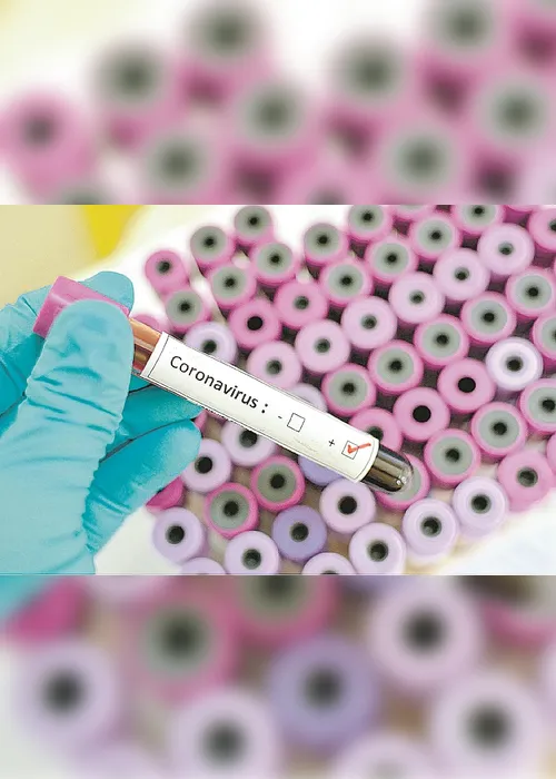 Imagem ilustrativa da imagem Servidores do laboratório que testa Covid no Estado estão infectados