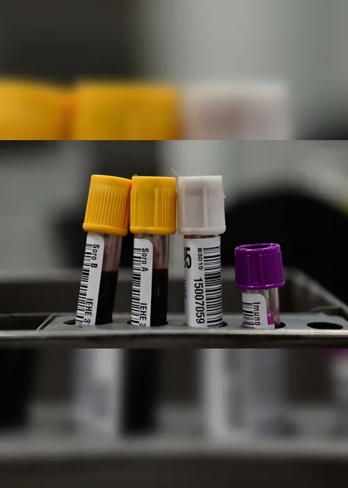Imagem ilustrativa da imagem Tipo sanguíneo e genes estão ligados à Covid-19 grave, mostra estudo