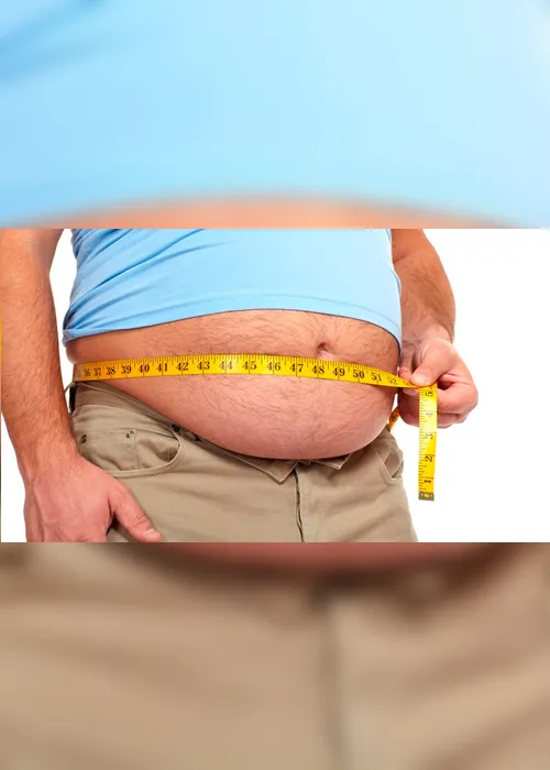 Imagem ilustrativa da imagem Obesidade é o principal fator de risco para pacientes com menos de 60 anos