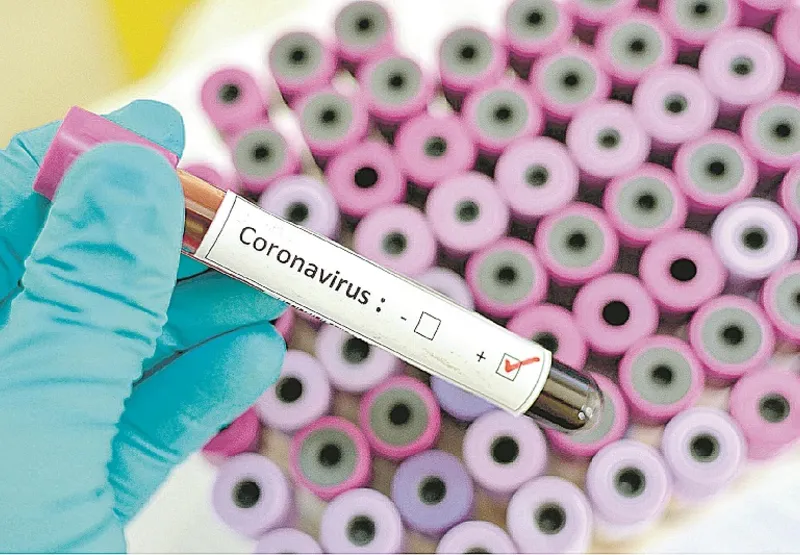 Testes de coronavírus são feitos em casos graves e em idosos e grávidas