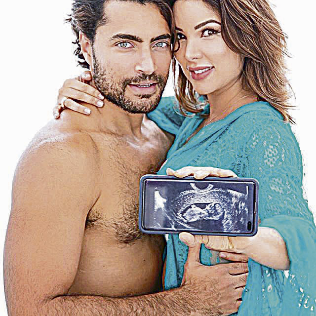 Carlo e Liah mostram ultrassom (Foto: Reprodução / Instagram)