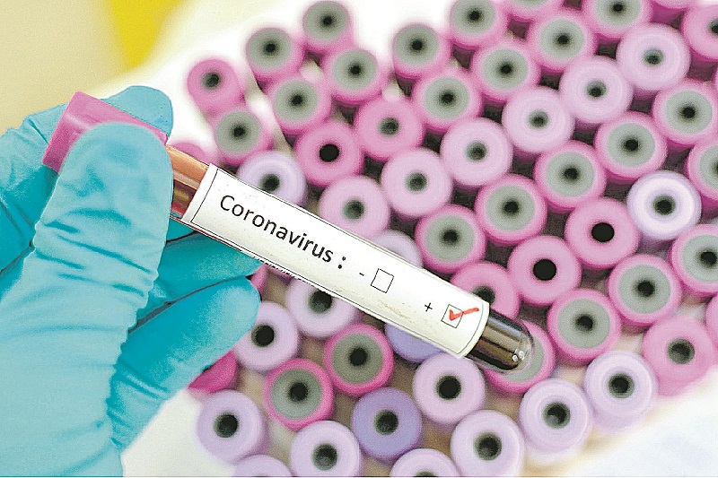 Testes de coronavírus (Foto: Agência Estado – 13/03/2020)
