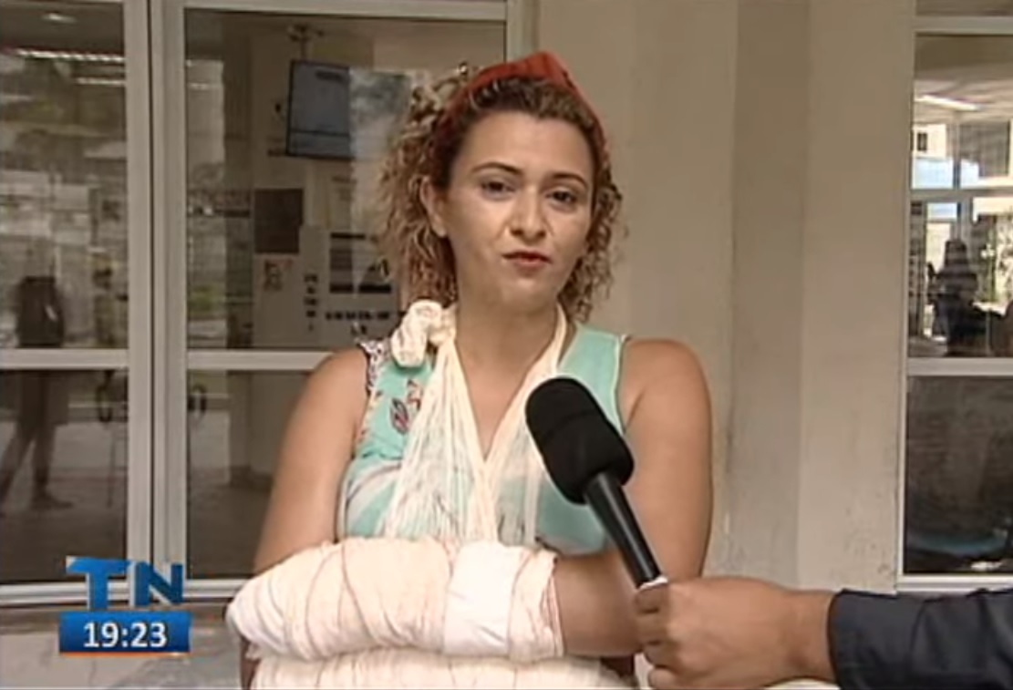 Azelina teve queimaduras de segundo grau (Foto: Reprodução TV Tribuna)
