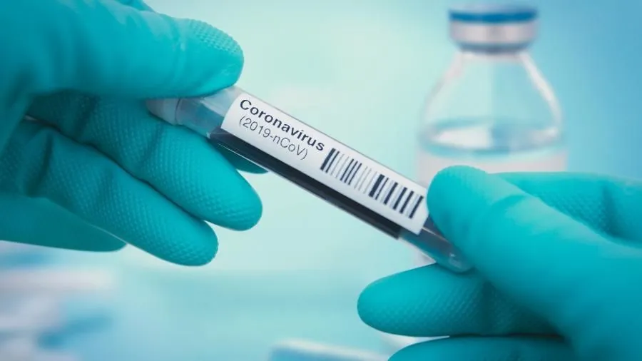 Imagem ilustrativa da imagem Vacina contra covid-19 desenvolvida em Oxford será testada no Brasil