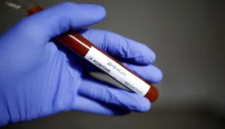 Imagem ilustrativa da imagem Mortalidade por Covid no Brasil é metade dos EUA