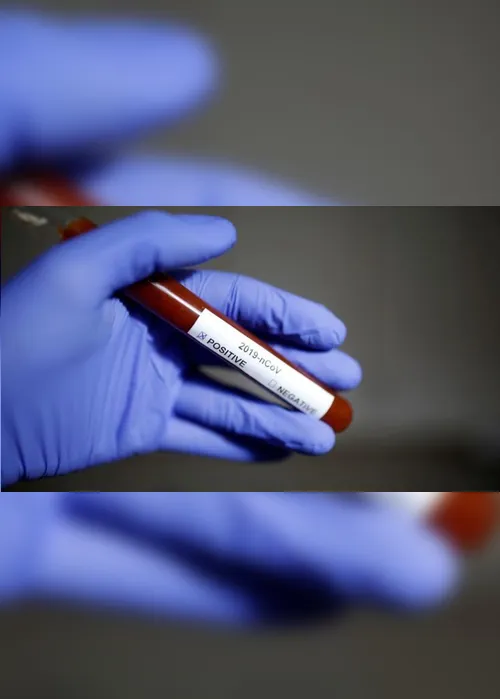 Imagem ilustrativa da imagem Brasil bate recorde com 26.417 novos casos de Covid-19 registrados em 24h