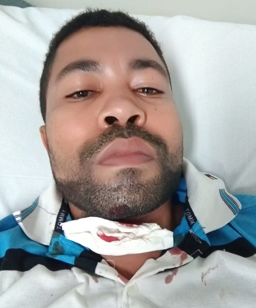 Motociclista se corta com linha de pipa com cerol (Foto: Acervo Pessoal)
