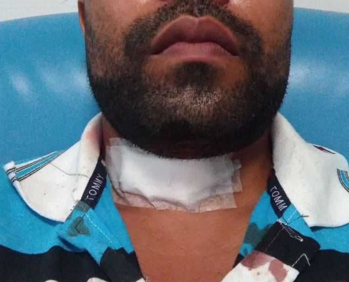 Motociclista precisou levar seis pontos (Foto: Acervo Pessoal)