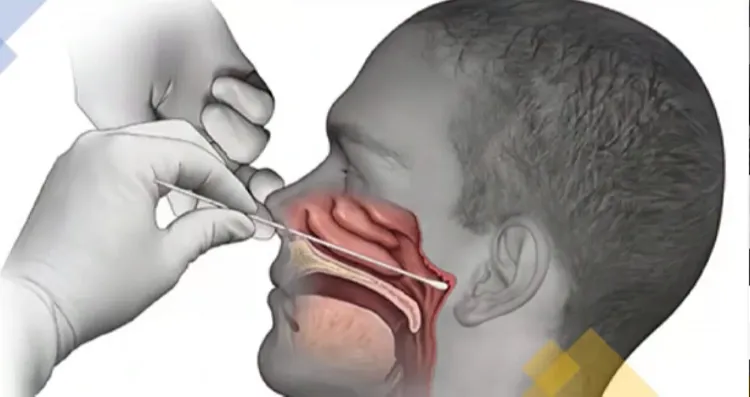 Imagem ilustrativa da imagem Qual a diferença entre os testes de covid-19?