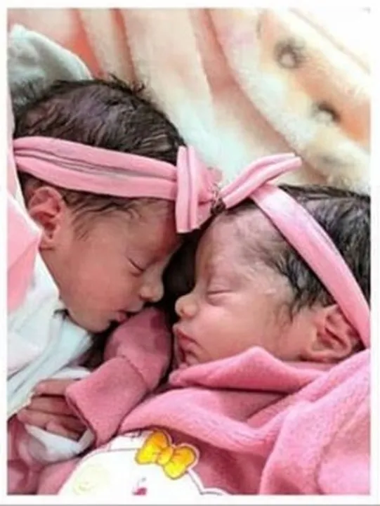 Imagem ilustrativa da imagem Gêmeas recém-nascidas morrem após ataque de cachorro