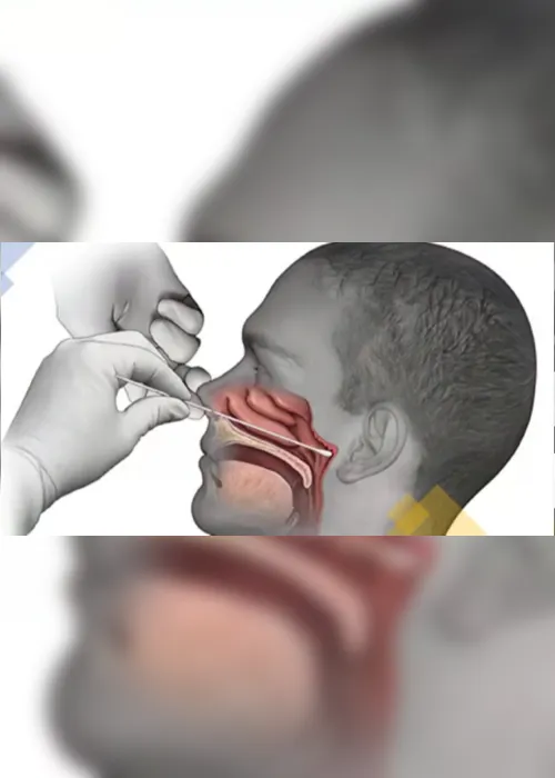 Imagem ilustrativa da imagem Qual a diferença entre os testes de covid-19?