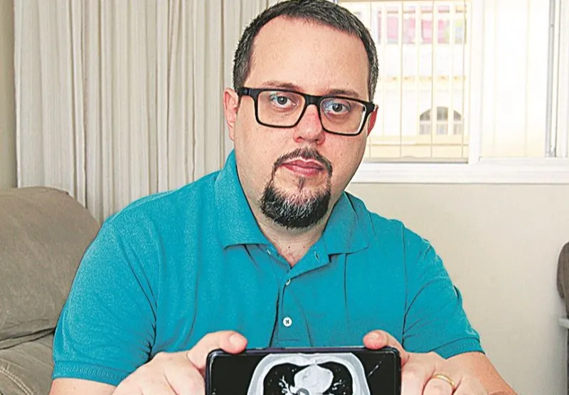 Felipe Cardoso mostra pulmão comprometido. Ele já voltou a trabalhar