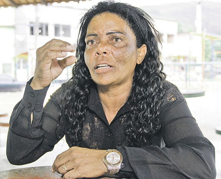 “A minha vida parou", diz Clemilda. (Foto: Leone Iglesias/AT - 01/11/2017)