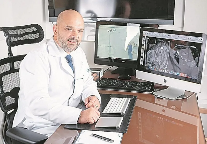 O radiologista Liborio Mule disse que o exame mostra sequelas e melhoras no pulmão