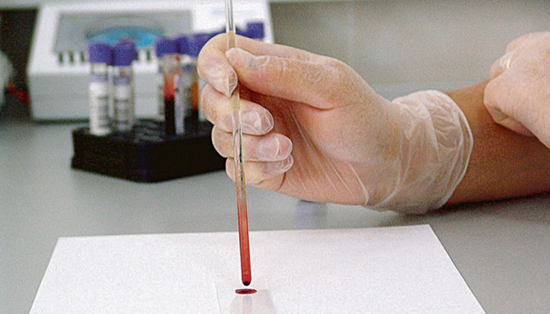 Amostra de Sangue é analisada em laboratório: pesquisa investiga as formas de transmissão da Covid-19 e sua disseminação no meio ambiente (Foto: Dayana Souza - 09/06/2020)