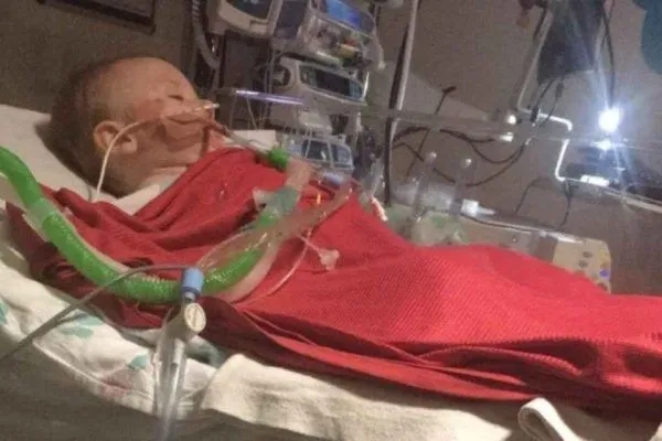 Imagem ilustrativa da imagem Bebê entra em coma após ingerir detergente para máquina de lavar louças