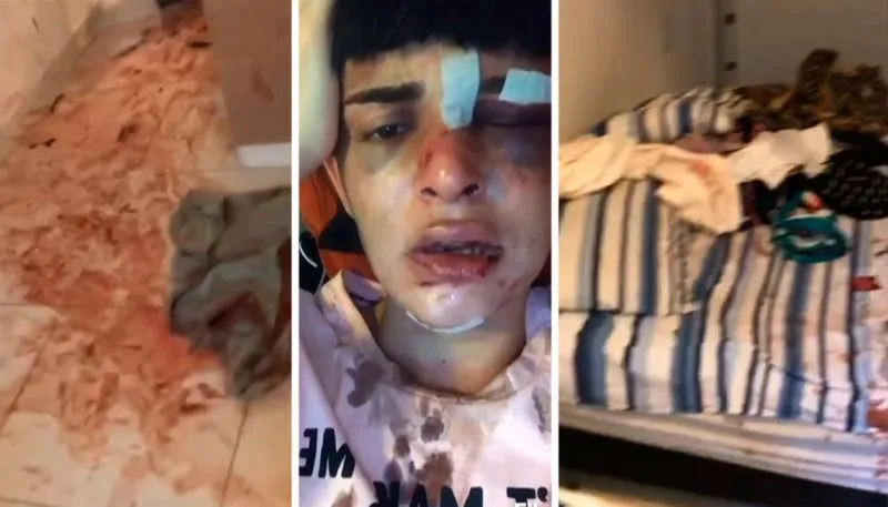 Imagem ilustrativa da imagem Capixaba, modelo trans é espancada e tem apartamento destruído no Rio