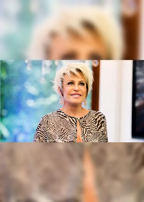 Imagem ilustrativa da imagem Ana Maria Braga revela que caiu da escada e quebrou o braço ao fugir de assédio de diretor