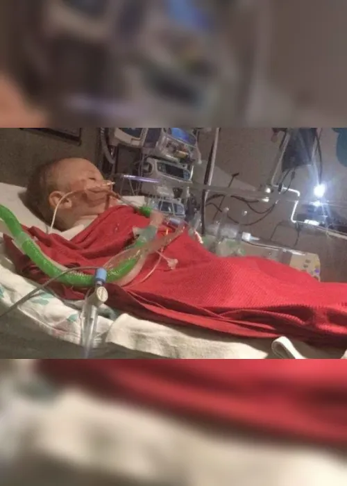 Imagem ilustrativa da imagem Bebê entra em coma após ingerir detergente para máquina de lavar louças