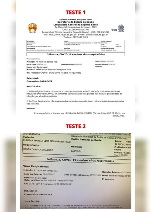 Imagem ilustrativa da imagem Contadora de Cachoeiro é diagnosticada pela segunda vez com coronavírus
