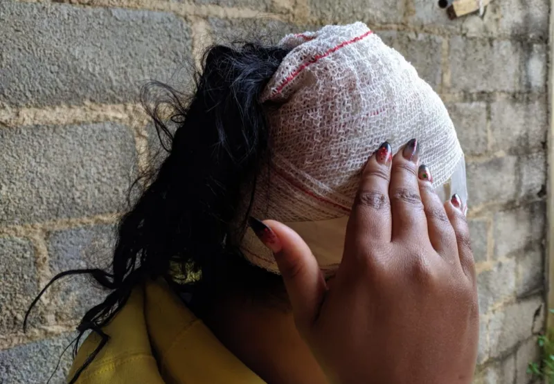 Uma salgadeira, de 32 anos, foi esfaqueada na cabeça