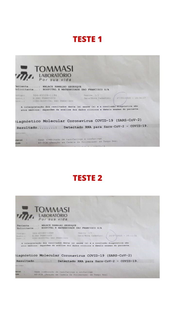 Exames do método Swab (Foto: Arquivo Pessoal)