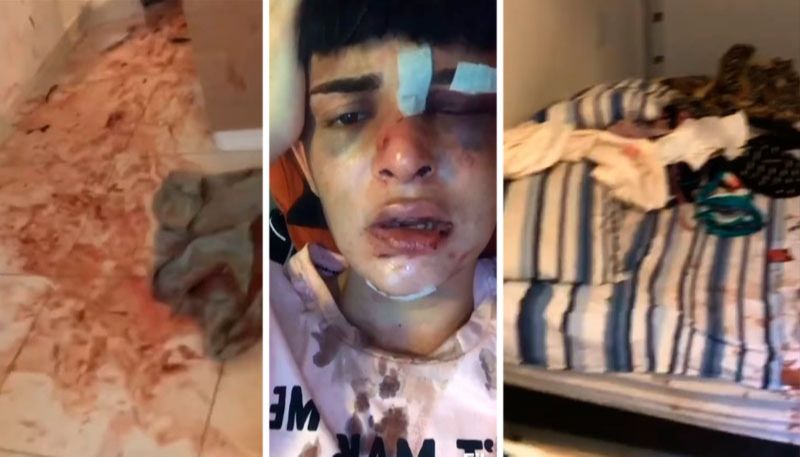 Alice Felis mostrou a casa destruída pelo agressor (Foto: Reprodução / Instagram)