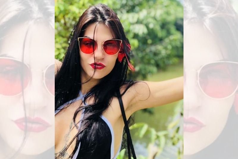 A modelo Katiuscia Silva, 31, teve 40% do corpo queimado na noite desta segunda-feira (10) (Foto: Acervo Pessoal)