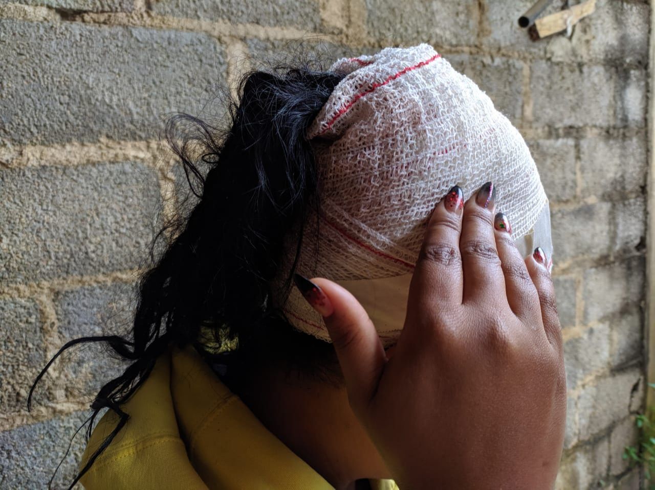 Uma salgadeira, de 32 anos, foi esfaqueada na cabeça (Foto: Júlia Afonso)